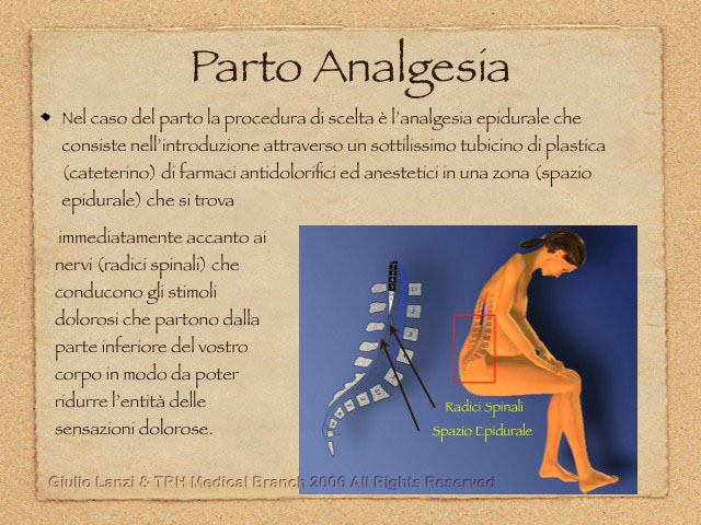 PartoAnalgesia.003