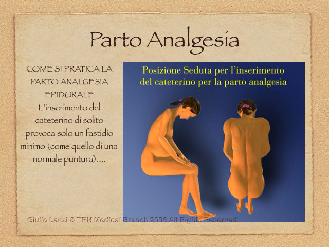 PartoAnalgesia.004