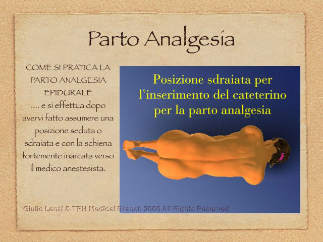 PartoAnalgesia.005