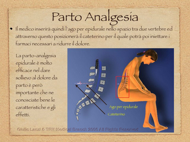PartoAnalgesia.007