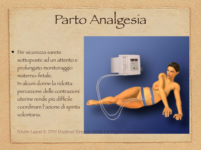 PartoAnalgesia.010